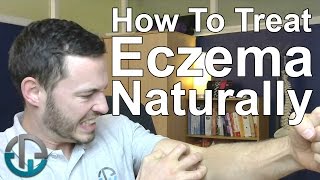 How To Treat Eczema Naturally [upl. by Enael]