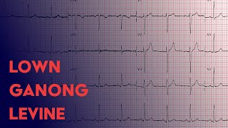 Lown Ganong Levine  ECG EKG Interpretation [upl. by Latsyrc]