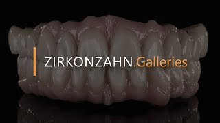 The PlaneSystem® amp Face Hunter for a case of edentulous maxilla and mandible  ZirkonzahnGalleries [upl. by Slavin]