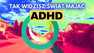 5 OBJAWÓW ADHD u dorosłych [upl. by Gotthard96]