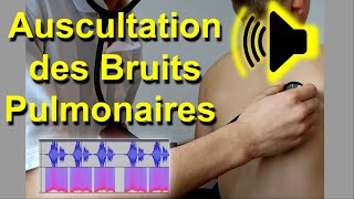 Bruits pulmonaires anormaux Auscultation Son Audio Poumon murmure vésiculaire frottement pleural [upl. by Guglielmo]