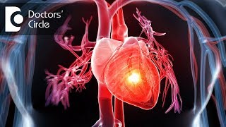 How to manage breathlessness in cardiac patients with a stent  Dr Durgaprasad Reddy B [upl. by Kieffer]