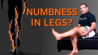 Numbness in Legs Causes and Treatment [upl. by Bert955]