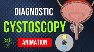 DIAGNOSTIC CYSTOSCOPY ANIMATION [upl. by Helbonnah]