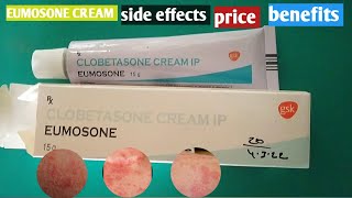 Eumosone Cream full review in hind Clobetasone cream Eumosone Cream review in hindi [upl. by Mosi]