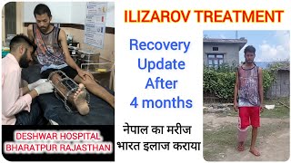 ILIZAROV TREATMENT RECOVERY UPDATE AFTER 4 MONTHS नेपाल से भारत इलाज कराने आया था tibia fracture [upl. by Nywles]