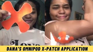 How to Apply Omnipod XPatches  Long Lasting CGM Patches  Danas XPatch TUTORIAL [upl. by Doyle]