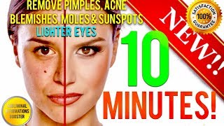 REMOVE DARK SPOTS BLEMISHES ACNE MOLES amp GET LIGHTER EYES IN 10 MINUTES SUBLIMINAL AFFIRMATIONS [upl. by Ahsilla902]