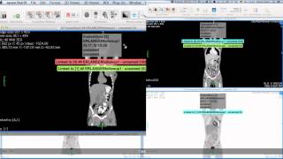 FusionSync 10  Introduction and Feature Overview [upl. by Ecinrev]