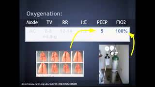 Lung Protective Vent Settings quotEM in 5quot [upl. by Derrek]