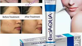 BioAqua Anti Acne Cream [upl. by Airemat]