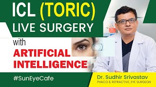 ICL Eye Surgery  Specs removal for High Numbers  ICL Toric Surgery refractivesurgery suneyecafe [upl. by Yong]