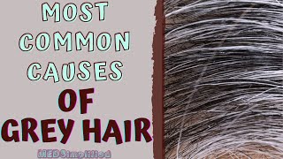 MOST COMMON CAUSES OF GREY HAIR [upl. by Ragouzis]