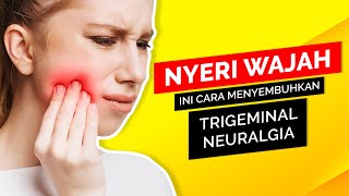 Nyeri Wajah Parah Ini Cara Menyembuhkan Trigeminal Neuralgia [upl. by Severen]