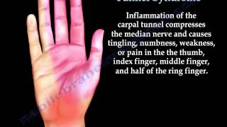 Anatomy of Carpal Tunnel Syndrome  Everything You Need To Know  Dr Nabil Ebraheim [upl. by Charlena]