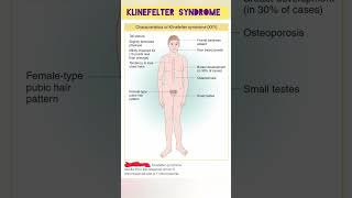 Klinefelter Syndrome Features  Genetic Disorder in Human [upl. by Jonathon]