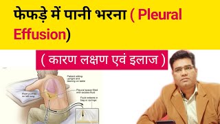 What is Pleural effusion its Cause Symptoms and Treatment Explained in Hindi फेफड़े में पानी [upl. by Cirala148]