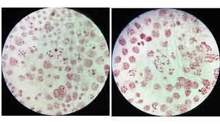 LeptoteneZygotenePachyteneDiplotene amp Diakinesis stages of meiosis with identifying characters [upl. by Oknuj211]