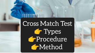 Cross Match Test  Procedure  Types  Method [upl. by Lessur]