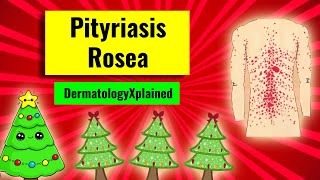 Pityriasis rosea christmastree rash clinical features associations histology and management [upl. by Okia]