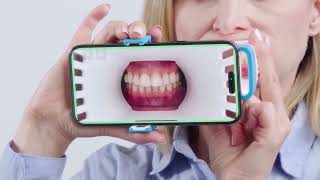 Invisalign Virtual Care [upl. by Atinnod]