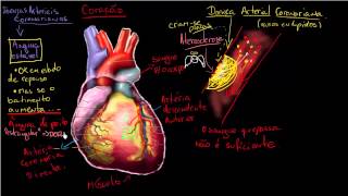 O que é Doença arterial coronariana [upl. by Eitsud]