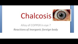 Ophthalmology 443 Chalcosis Alloy Copper Eye Kayser Fleischer ring sunflower cataract [upl. by Ul183]