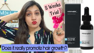 I tried Minimalist Hair Growth Actives 18 for 8 Weeks Review after 2 Months [upl. by Hathcock]