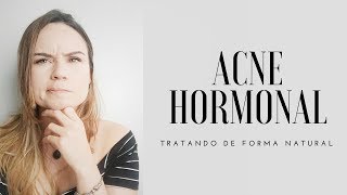 ACNE HORMONAL  COMO TRATAR DE FORMA NATURAL [upl. by Gustin]