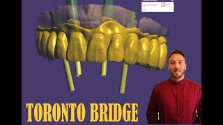 Toronto Bridge [upl. by Yrevi565]