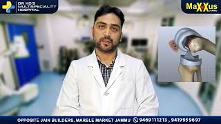 घुटने की रिप्लेसमेंट सर्जरी क्या है  What is knee replacement surgery Dr Nitin Sharma Ortho Hindi [upl. by Lindley]