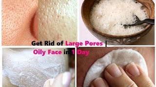 Get Rid of Large Pores  Open Pores  Oily Face in 1 Day  5 Instant Remedies [upl. by Areehs]