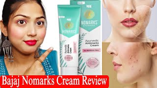 Bajaj Nomarks Cream Review  Remove Acne Scars Dark Spots Blemish  For Normal Skin [upl. by Aohsoj725]