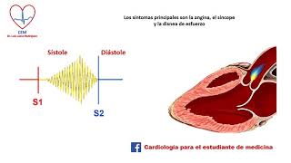 Auscultación de la estenosis valvular aórtica [upl. by Hoag]