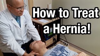 Hiatal Hernia Relief Technique [upl. by Ellehcit]