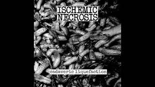 Ischemic Necrosis  Traumatic Asphyxia [upl. by Gould]