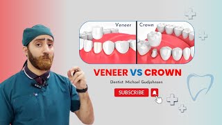 Veneer vs Crown  which is best for teeth  Doctor Gudjohnsen [upl. by Irpac736]