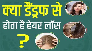 Does dandruff cause Hair Loss क्या डैंड्रफ से होता है हेयर लॉस [upl. by Bettencourt]