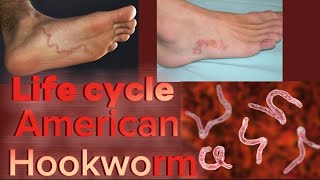 Life Cycle of American Hookworm  Necator Americanus  Phylum Nematoda  English [upl. by Anirtep152]