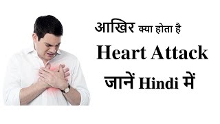 Myocardial InfarctionHeart Attack  हार्ट अटैकदिल का दौरा पड़ना  जानें Hindi में [upl. by Alegnat858]