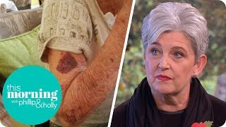 My Mother Suffered Shocking Care Home Abuse  This Morning [upl. by Mickey409]