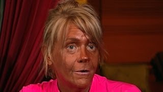 Tanning Mom In Court Denies Daughter 5 Burned in Tan Salon Does She Suffer from Tanorexia [upl. by Hallette]