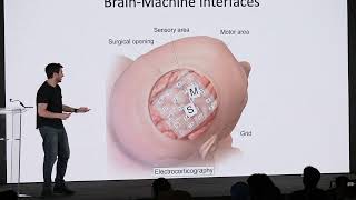 Brain Machine Interface  Tim Urban [upl. by Arata]