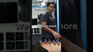 How To Tell If Cupping Is Working [upl. by Amian]