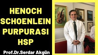 Henoch Schonlein Purpurası HSP Serdar Akgün [upl. by Tierell601]