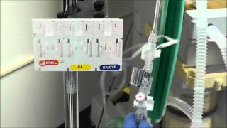 How to Setup an Arterial Line Transducer [upl. by Volny]