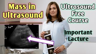 Can masses be seen on ultrasound  Does hypoechoic mass mean cancer [upl. by Ilarrold]