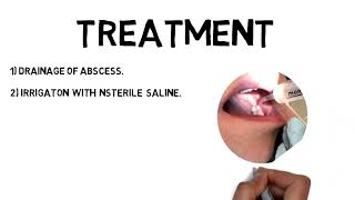 Pericoronitis Treatment  Clinical features amp Complications [upl. by Giltzow]