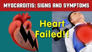 Myocarditis Symptoms and Treatment Options myocarditis myocardialinfarction [upl. by Norra]