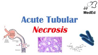 Acute Tubular Necrosis ATN  Symptoms Causes and Treatments [upl. by Nevek]